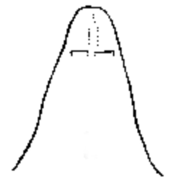 Distal portion of penes of male Baetisca obesa
